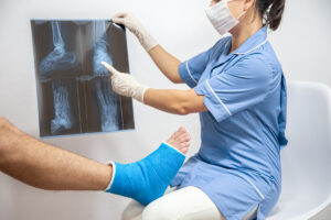 Médica mostrando raio-x do tornozelo para paciente