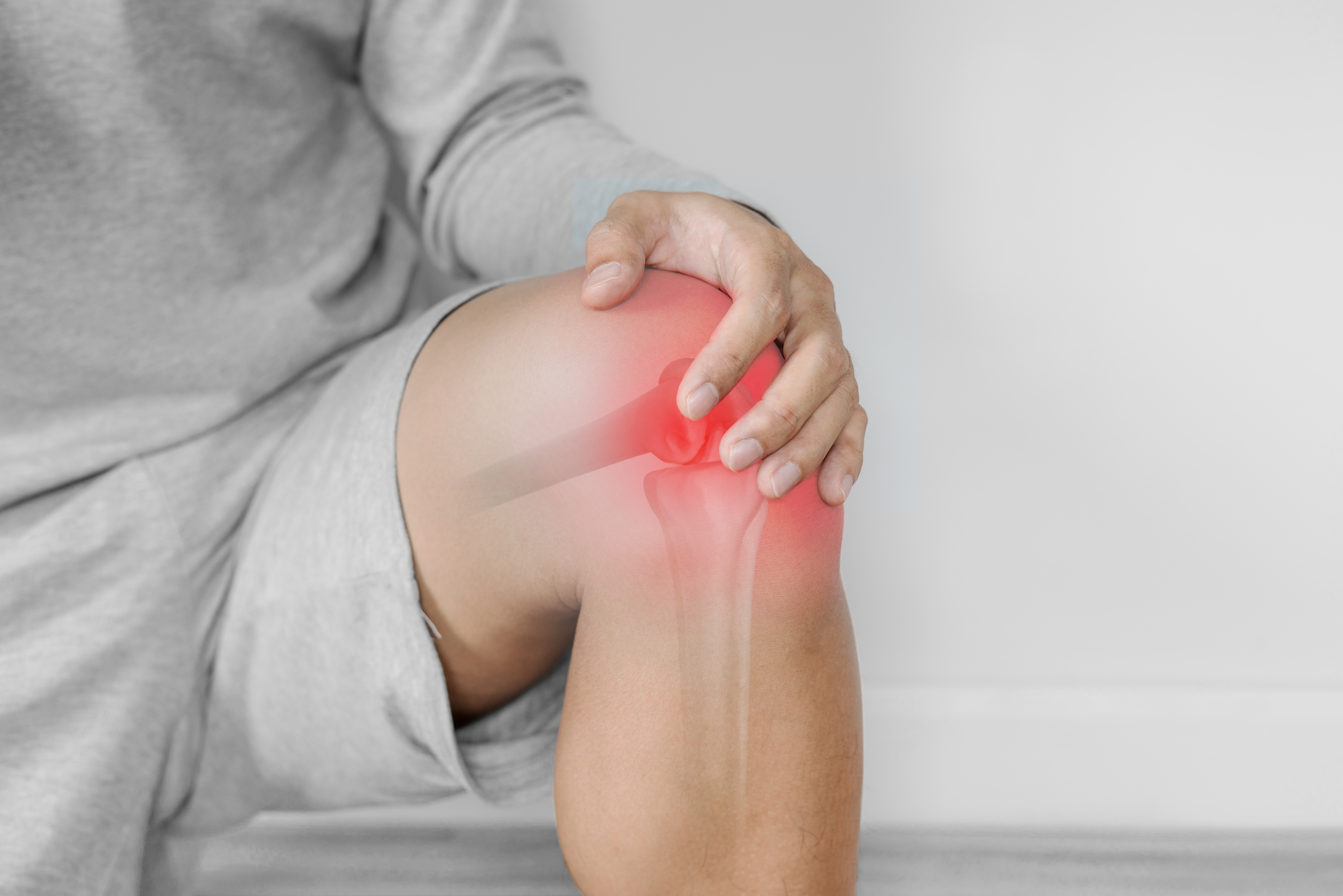 Imagem representativa de artrose no joelho