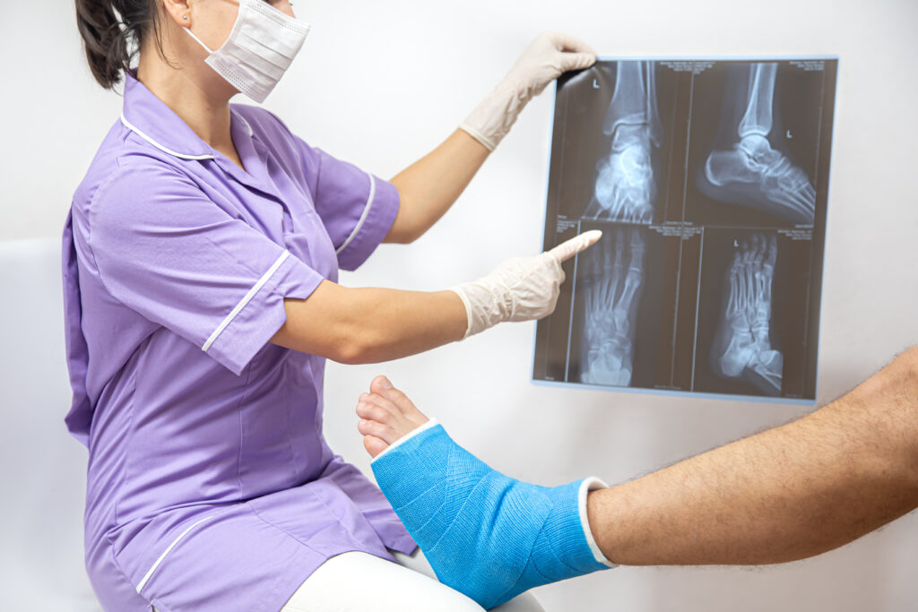 Imagem de um médico mostrando raio-x do pé